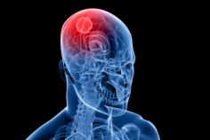 Welt-Hirntumor-Tag 2026