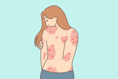 Welt-Psoriasistag 2026